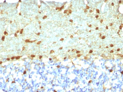 Formalin-fixed, paraffin embedded rat sections stained with 100 ul anti-Fascin-1 (clone FSCN1/418) at 1:300. HIER epitope retrieval prior to staining was performed in 10mM Tris 1mM EDTA, pH 9.0.